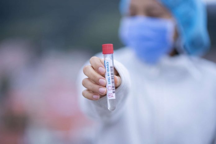 Mobilny Punk Pobrań w Bydgoszczy - COVID-19