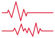 Holter EKG w profilaktyce i ocenie ryzyka chorób sercowo-naczyniowych Holter EKG