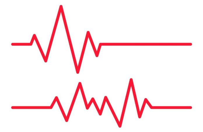 Holter EKG Holter EKG